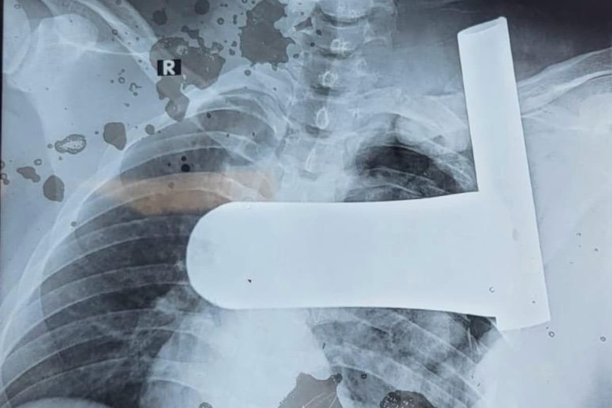 मरीज की सीटी स्कैन रिपोर्ट.