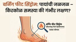 Burning Feet Syndrom: कोणत्या व्हिटॅमिनच्या कमतरतेमुळे तळपायात जळजळ होते? दुर्लक्ष करू नका, जाणून घ्या माहिती