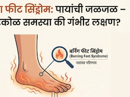 Burning Feet Syndrom: कोणत्या व्हिटॅमिनच्या कमतरतेमुळे तळपायात जळजळ होते? दुर्लक्ष करू नका, जाणून घ्या माहिती
