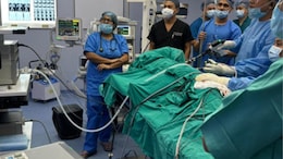 Tripura Healthcare Milestone: 2 Consecutive Kidney Transplants Performed In State's History