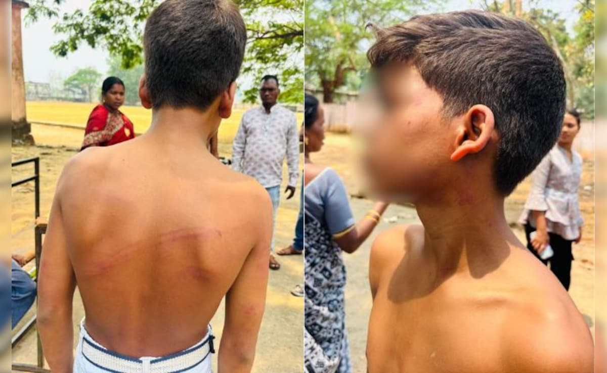 हॉस्टल में सीनियर्स का आतंक! नींद से जगाकर दो जूनियर को लोहे की रॉड से पीटा, घायल छात्र अस्पताल में भर्ती