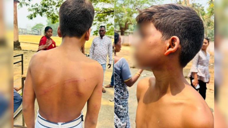 हॉस्टल में सीनियर्स का आतंक! नींद से जगाकर दो जूनियर को लोहे की रॉड से पीटा, घायल छात्र अस्पताल में भर्ती