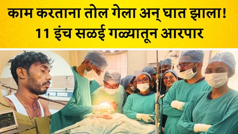 MP News: 11 इंच लोखंडी सळई तरुणाच्या गळ्यात आरपार घुसली, अपघात पाहून प्रत्यक्षदर्शींच्या पायाखालची जमीन सरकली