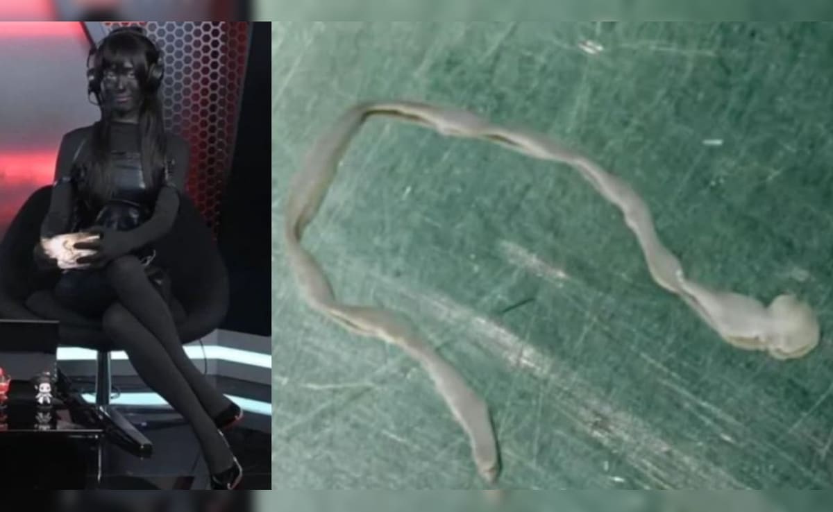 अजब-गजब किस्से: महिला के दिमाग से निकला 3 इंच का रेंगता कीड़ा, गेमिंग होस्ट ने क्यों काला कर लिया अपना चेहरा?