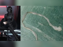 अजब-गजब किस्से: महिला के दिमाग से निकला 3 इंच का रेंगता कीड़ा, गेमिंग होस्ट ने क्यों काला कर लिया अपना चेहरा?