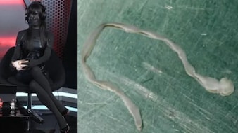 अजब-गजब किस्से: महिला के दिमाग से निकला 3 इंच का रेंगता कीड़ा, गेमिंग होस्ट ने क्यों काला कर लिया अपना चेहरा?