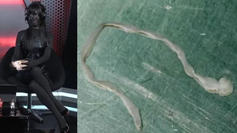 अजब-गजब किस्से: महिला के दिमाग से निकला 3 इंच का रेंगता कीड़ा, गेमिंग होस्ट ने क्यों काला कर लिया अपना चेहरा?