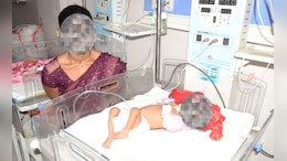 MP में पोषण अभियान पर उठे सवाल; सतना के नयागांव में कुपोषण का नया कलंक, गंभीर कुपोषित बच्ची का एक कान ही नहीं