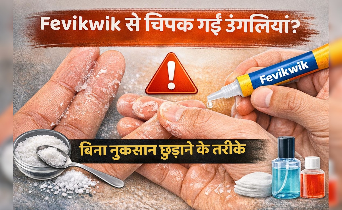 Fevikwik से उंगलियां चिपक जाएं तो क्या करें? बिना नुकसान छुड़ाने के आसान तरीके