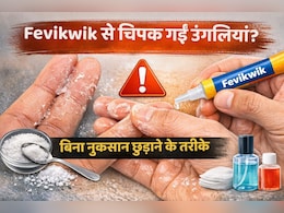 Fevikwik से उंगलियां चिपक जाएं तो क्या करें? बिना नुकसान छुड़ाने के आसान तरीके