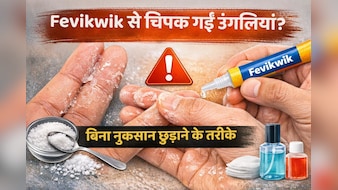 Fevikwik से उंगलियां चिपक जाएं तो क्या करें? बिना नुकसान छुड़ाने के आसान तरीके