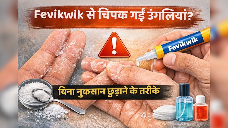 Fevikwik से उंगलियां चिपक जाएं तो क्या करें? बिना नुकसान छुड़ाने के आसान तरीके