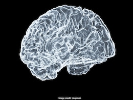 IIT Madras Releases World's Most Detailed 3D Human Brainstem Atlas