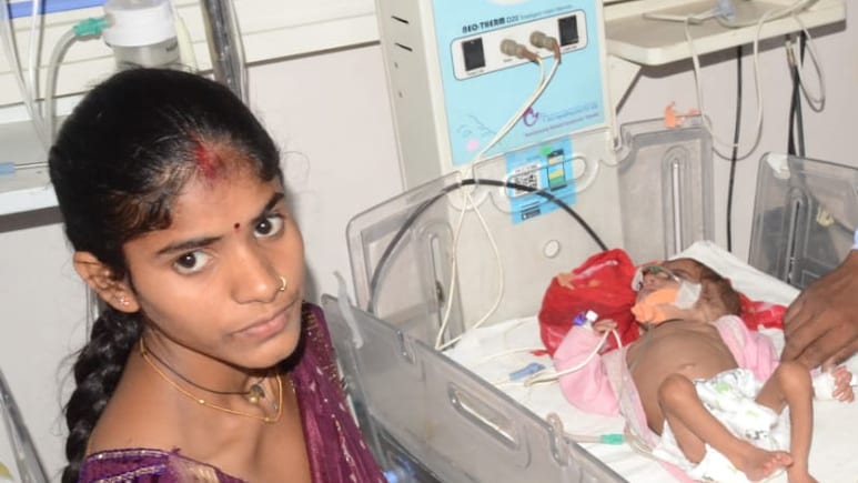 Satna News: सुरांगी के बाद नयागांव में मिली कुपोषित बच्ची, हालत बिगड़ने पर मेडिकल कॉलेज रीवा रेफर