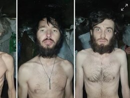 90 KG से 50 KG हो गए... किस हालत में Frontline पर जंग लड़ रहे यूक्रेन के सैनिक, तस्वीरें हुईं लीक