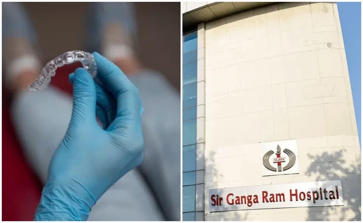 फूड पाइप में फंसी थी नकली दांतों की प्लेट, डॉक्टरों ने बिना ओपन सर्जरी के बचाई मरीज की जान