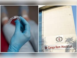 फूड पाइप में फंसी थी नकली दांतों की प्लेट, डॉक्टरों ने बिना ओपन सर्जरी के बचाई मरीज की जान