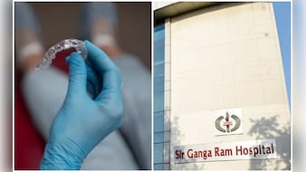 फूड पाइप में फंसी थी नकली दांतों की प्लेट, डॉक्टरों ने बिना ओपन सर्जरी के बचाई मरीज की जान