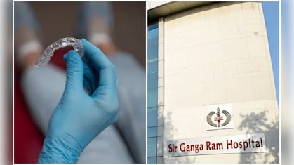 फूड पाइप में फंसी थी नकली दांतों की प्लेट, डॉक्टरों ने बिना ओपन सर्जरी के बचाई मरीज की जान