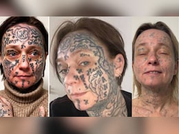 प्यार या पागलपन? 'सनकी' प्रेमी ने गर्लफ्रेंड को बनाया 'टैटू मशीन', अब मिटाए जा रहे हैं दरिंदगी के निशान