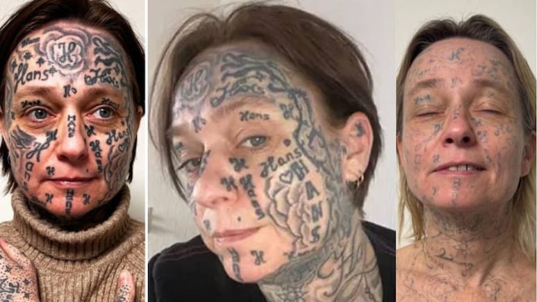 प्यार या पागलपन? 'सनकी' प्रेमी ने गर्लफ्रेंड को बनाया 'टैटू मशीन', अब मिटाए जा रहे हैं दरिंदगी के निशान