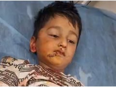 राजस्थान: घर के बाहर खेल रहे 5 साल के बच्चे पर आवारा कुत्ते ने किया हमला, चेहरे और कान पर आए 20 टांके