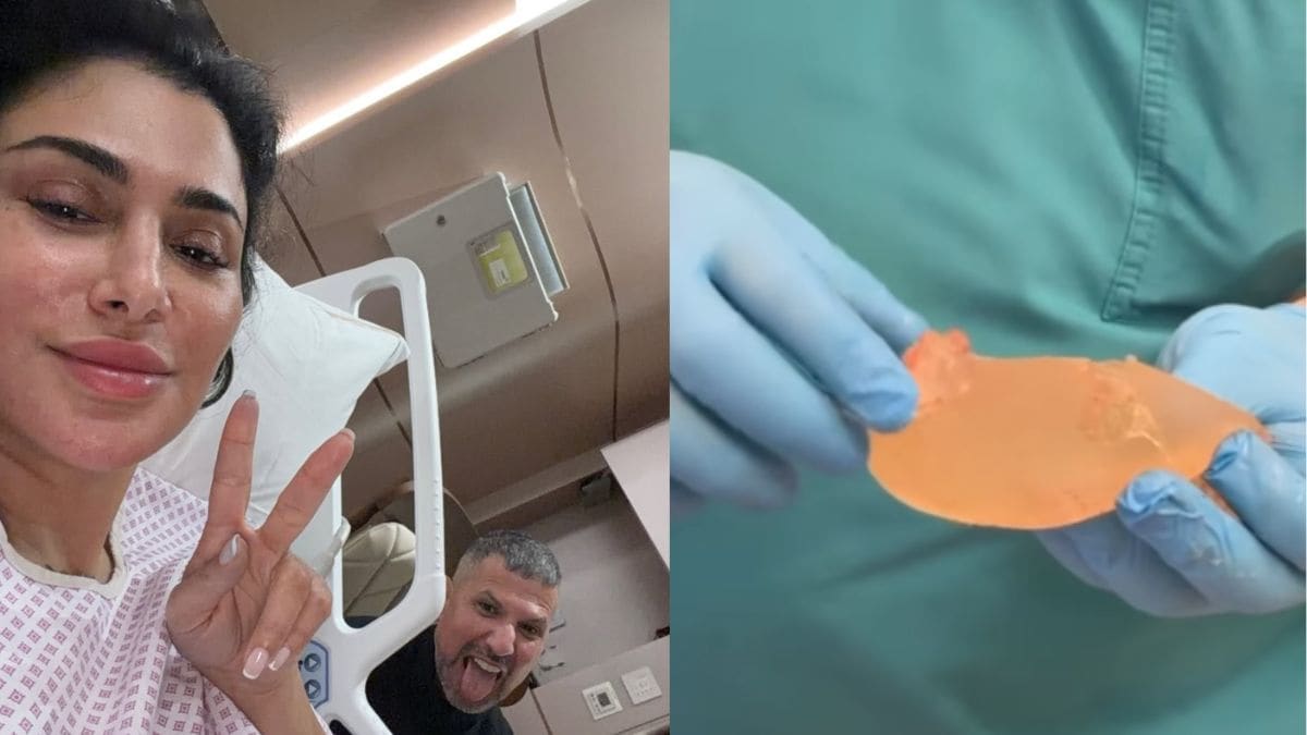 But, there was a lot of inflammatory fluid and "an infection had started," Huda further revealed. Photo: Huda Kattan/ Instagram