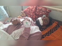 शौच कर रहे युवक पर भेड़िए का हमला, बुरी तरह से किया लहूलुहान; फिर गांव वालों ने भेड़िए को पकड़कर मार डाला