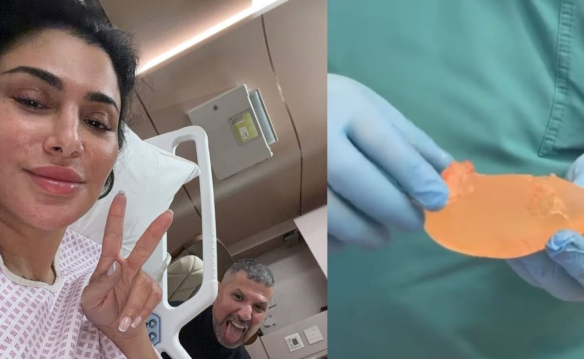 Sometimes people can get sick because of the implant. Doctors might need to take it out. Photo: Huda Kattan/ Instagram