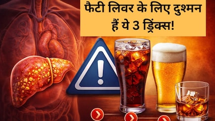 फैटी लिवर का खतरा बढ़ा रही हैं आपकी ये 3 फेवरेट ड्रिंक्स, AIIMS ट्रेंड डॉक्टर...