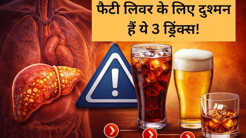 फैटी लिवर का खतरा बढ़ा रही हैं आपकी ये 3 फेवरेट ड्रिंक्स, AIIMS ट्रेंड डॉक्टर...