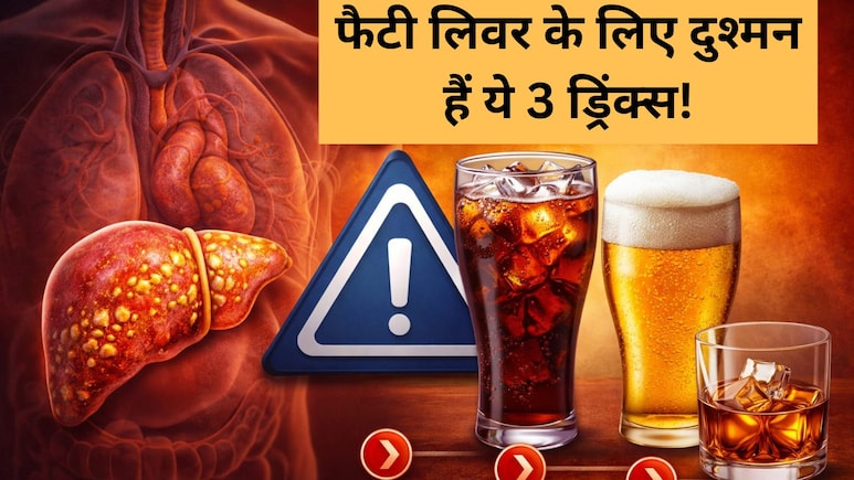 फैटी लिवर का खतरा बढ़ा रही हैं आपकी ये 3 फेवरेट ड्रिंक्स, AIIMS ट्रेंड डॉक्टर...
