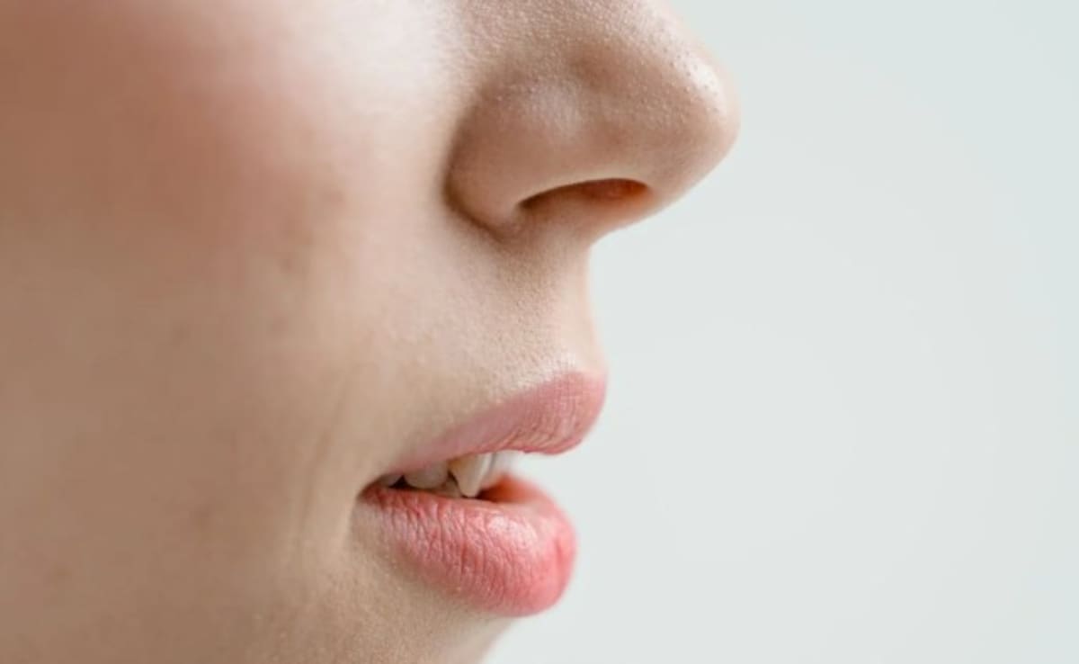 In "Biologically Implausible" Case, Greek Woman Sneezes 'Worms' Out Of Her Nose