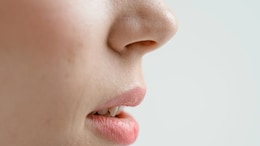 In "Biologically Implausible" Case, Greek Woman Sneezes 'Worms' Out Of Her Nose