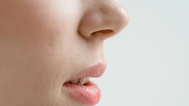 In "Biologically Implausible" Case, Greek Woman Sneezes 'Worms' Out Of Her Nose