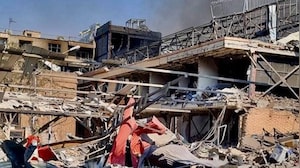 US-Israel Strike Hits Pasteur Institute of Iran | Iran Condemns Attack on Historic Medical Facility