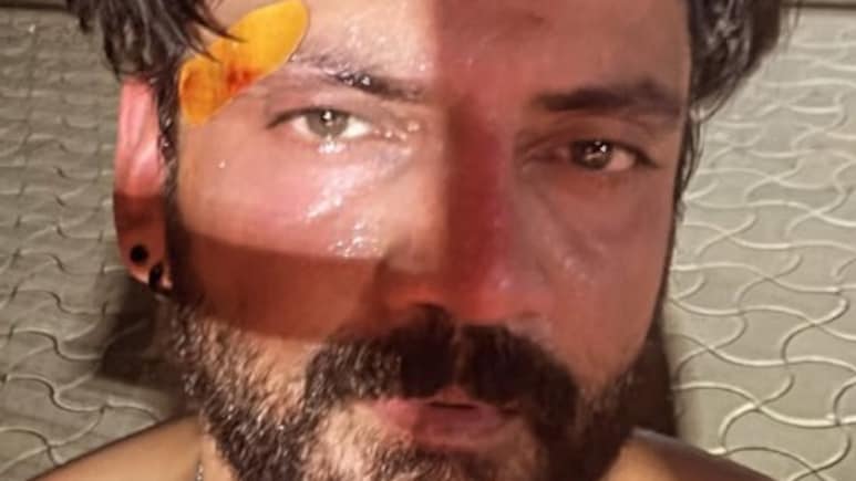 Zaheer Iqbal Suffers Injury While Playing Sports. See Pic