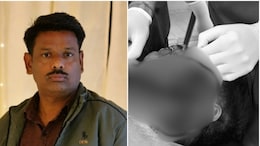बूंदी में 11KV तार से झुलसे बाइक सवार की 3 घंटे चली सर्जरी, आए 100 टांके; गर्दन चीरकर बनानी पड़ी सांस की नली