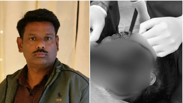 बूंदी में 11KV तार से झुलसे बाइक सवार की 3 घंटे चली सर्जरी, आए 100 टांके; गर्दन चीरकर बनानी पड़ी सांस की नली