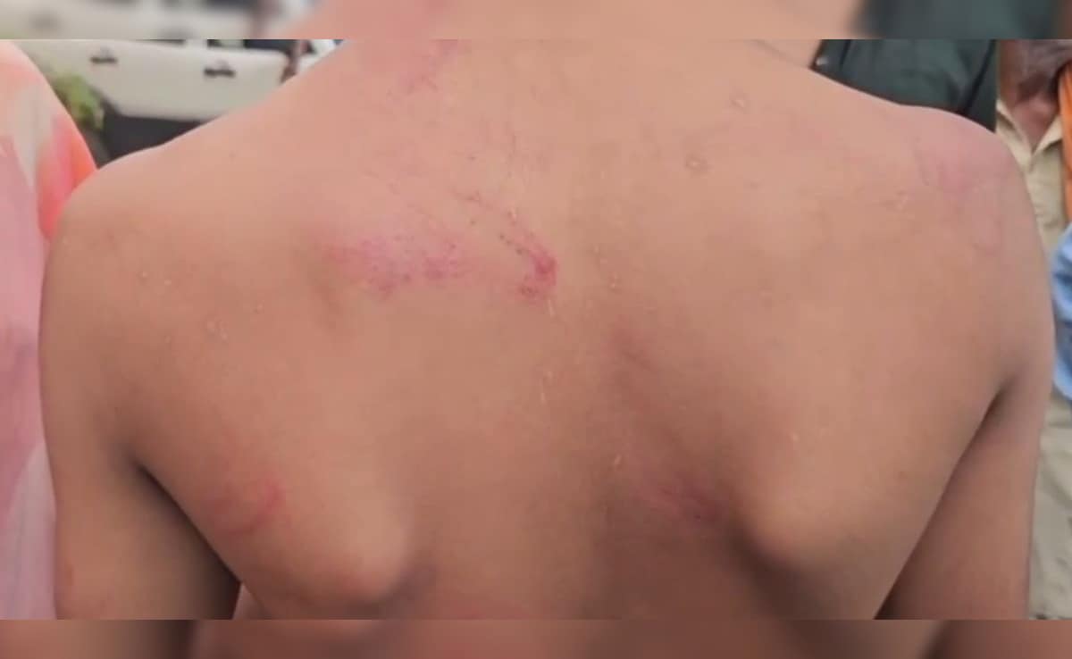 ब‍िहार: प्राइवेट स्कूल में छात्र की बेल्ट से पिटाई, स्‍कूल में परिजनों से धक्का-मुक्की पर हंगामा