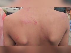 ब‍िहार: प्राइवेट स्कूल में छात्र की बेल्ट से पिटाई, स्‍कूल में परिजनों से धक्का-मुक्की पर हंगामा