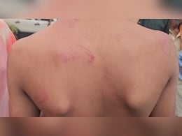 ब&zwj;िहार: प्राइवेट स्कूल में छात्र की बेल्ट से पिटाई, स्&zwj;कूल में परिजनों से धक्का-मुक्की पर हंगामा