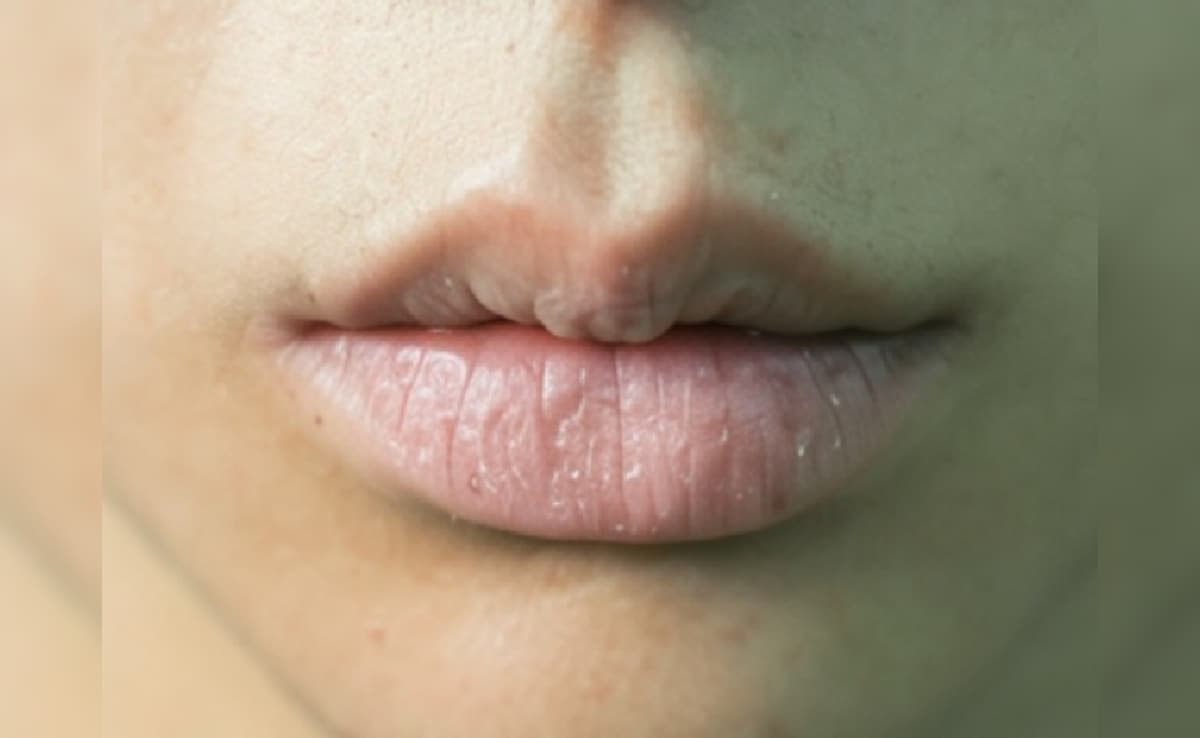 फटे होंठ से लेकर झुर्रियों तक, इन चीजों को वैसलीन में मिलाकर लगाने से मिलेगा आराम