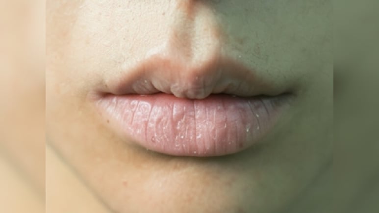फटे होंठ से लेकर झुर्रियों तक, इन चीजों को वैसलीन में मिलाकर लगाने से मिलेगा आराम