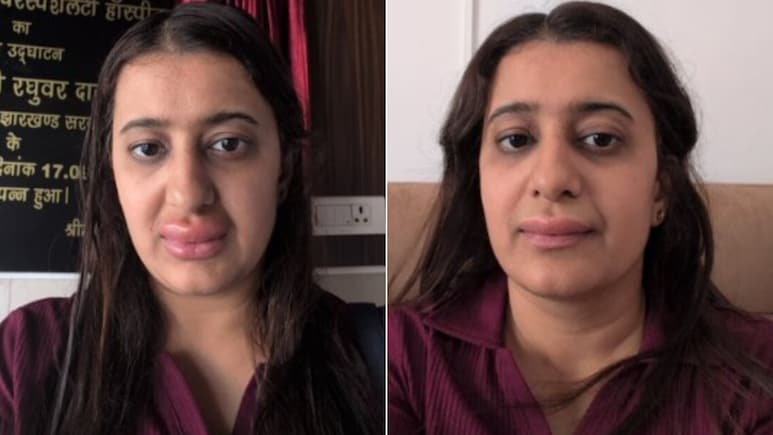 वंदे भारत के खाने से बिगड़ी महिला की तबीयत! बच्चे को हुआ डायरिया, शिकायत पर IRCTC ने दिया ये जवाब