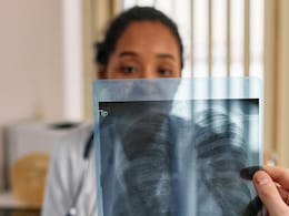 New TB Test Using AI: अब एआई करेगा टीबी दवा-प्रतिरोध की सटीक पहचान, जांच का बदल जाएगा तरीका