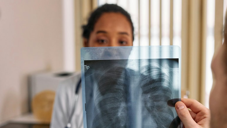 New TB Test Using AI: अब एआई करेगा टीबी दवा-प्रतिरोध की सटीक पहचान, जांच का बदल जाएगा तरीका