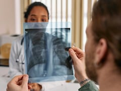 अब एआई करेगा टीबी दवा-प्रतिरोध की सटीक पहचान, जांच का बदल जाएगा तरीका