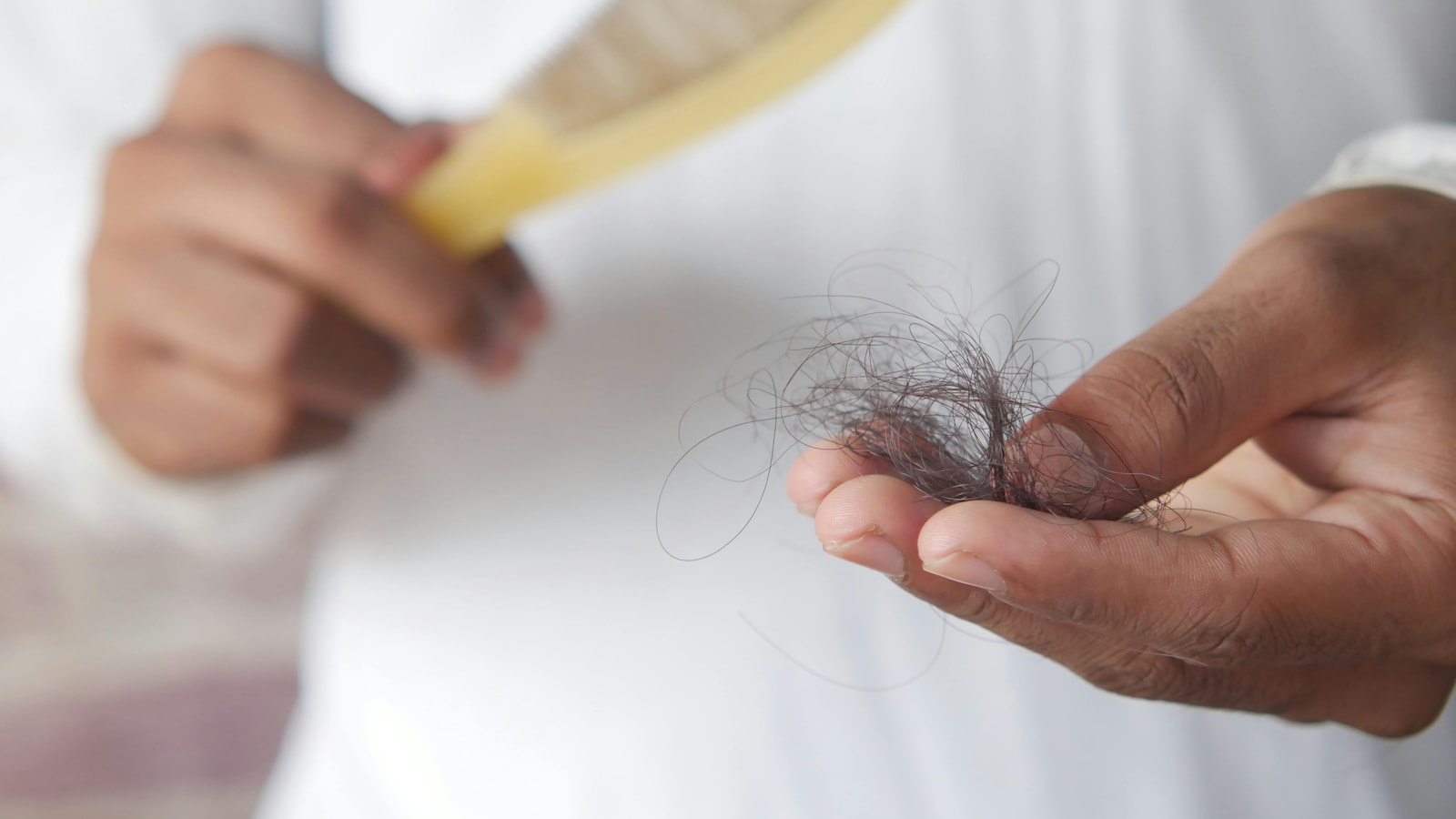 Nutrient Deficiencies May Contribute to Worsening Hair Loss