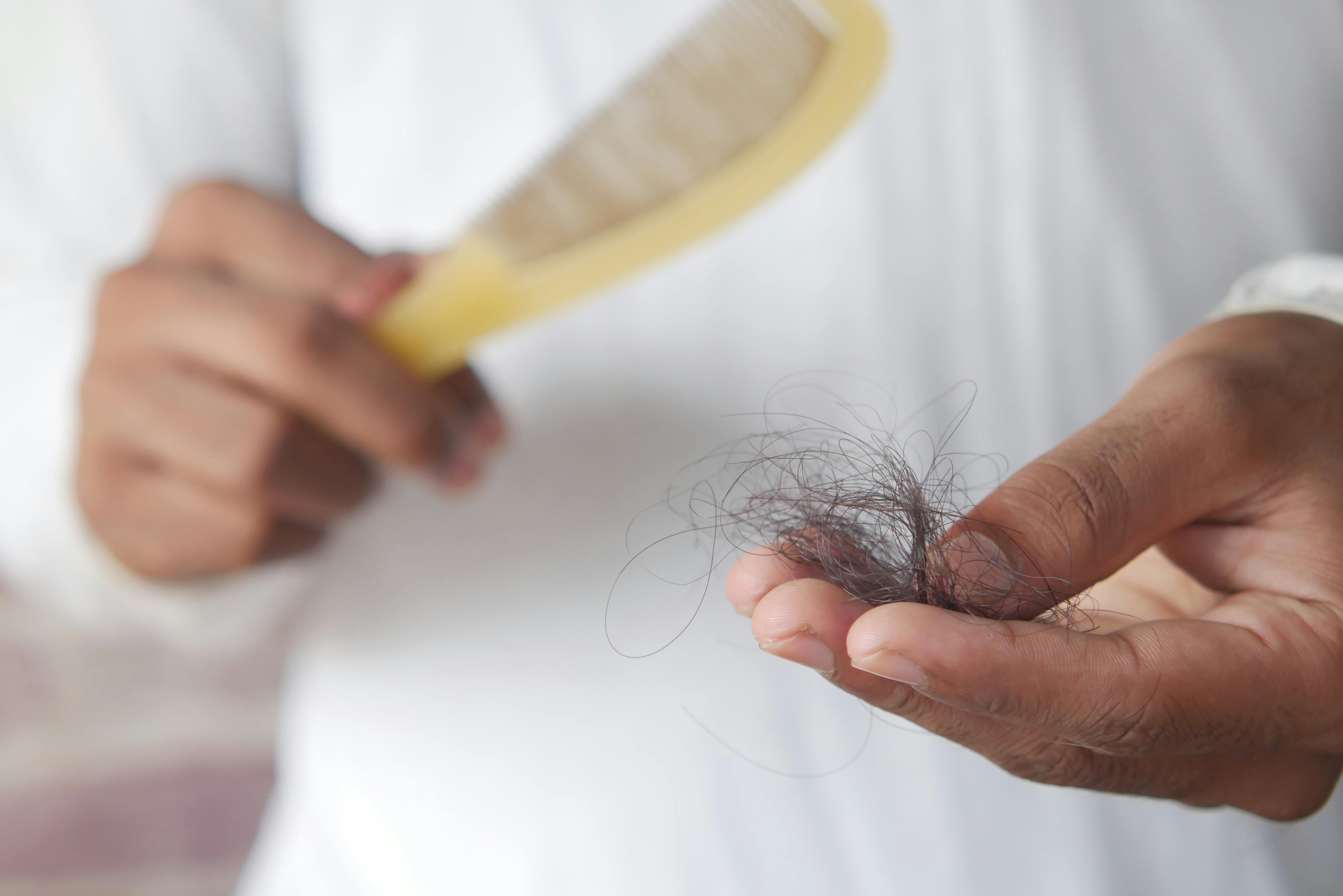 Hair loss causes